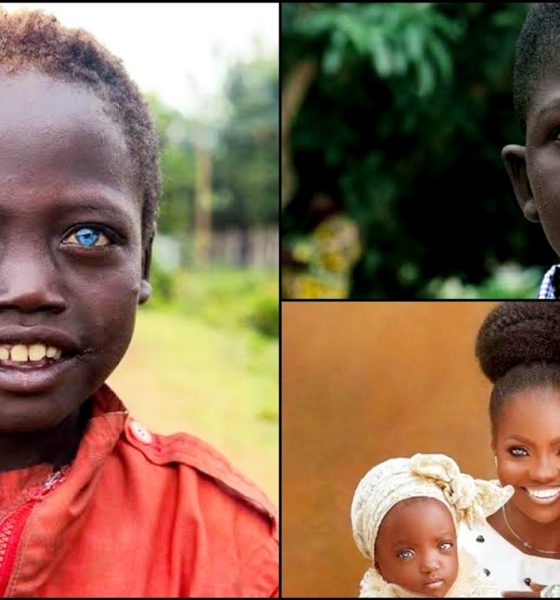 The Hidden Secrets Behind Black Africans With Blue Eyes