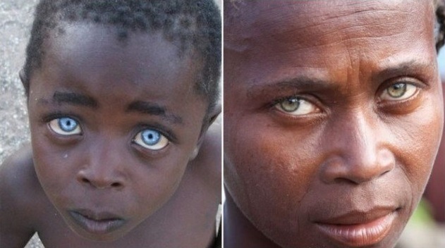 Blue Eyes Africans