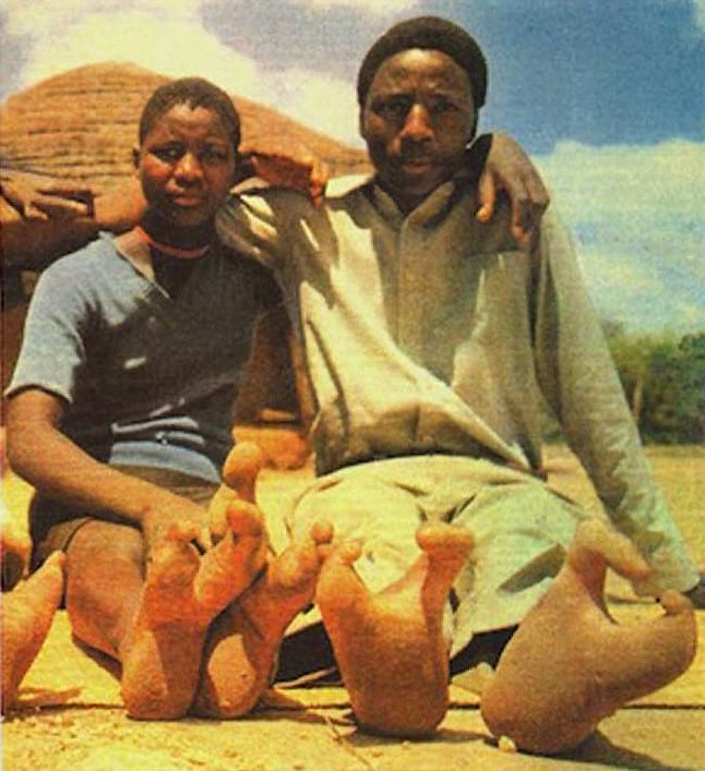 Vadoma People Of Zimbabwe With Ostrich Toe