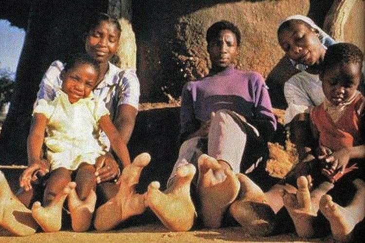 Vadoma People Of Zimbabwe With Ostrich Toe