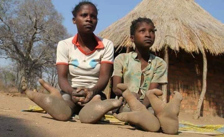 Vadoma People Of Zimbabwe With Ostrich Toe